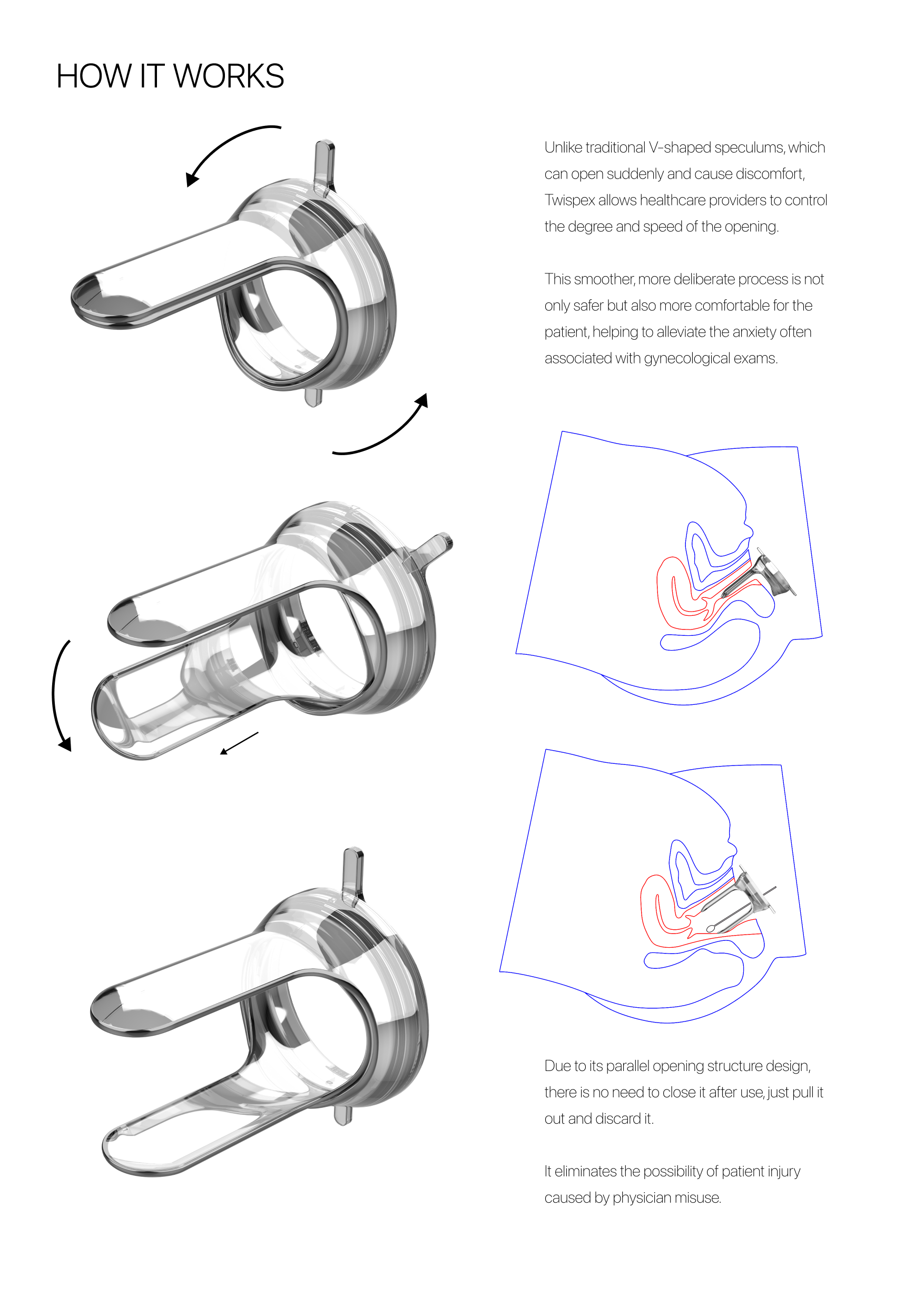 London Design Awards Winner - Twispex Speculum